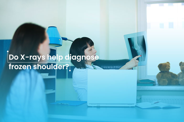 Do X-rays help diagnose frozen shoulder? 