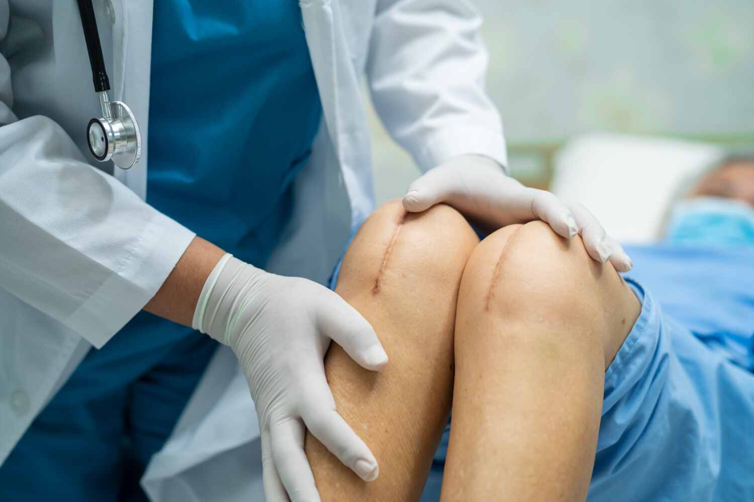 Downsides of Knee Replacement Surgery and the Introduction of Non Surgical Treatment at Dr. Sumitz