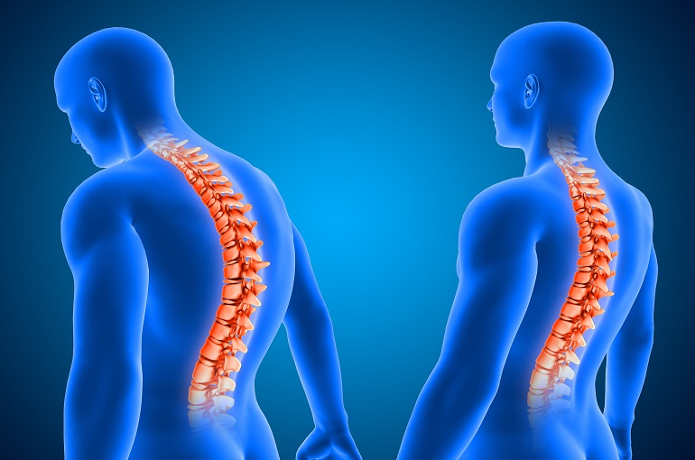 The Importance of Posture in Spine Health 