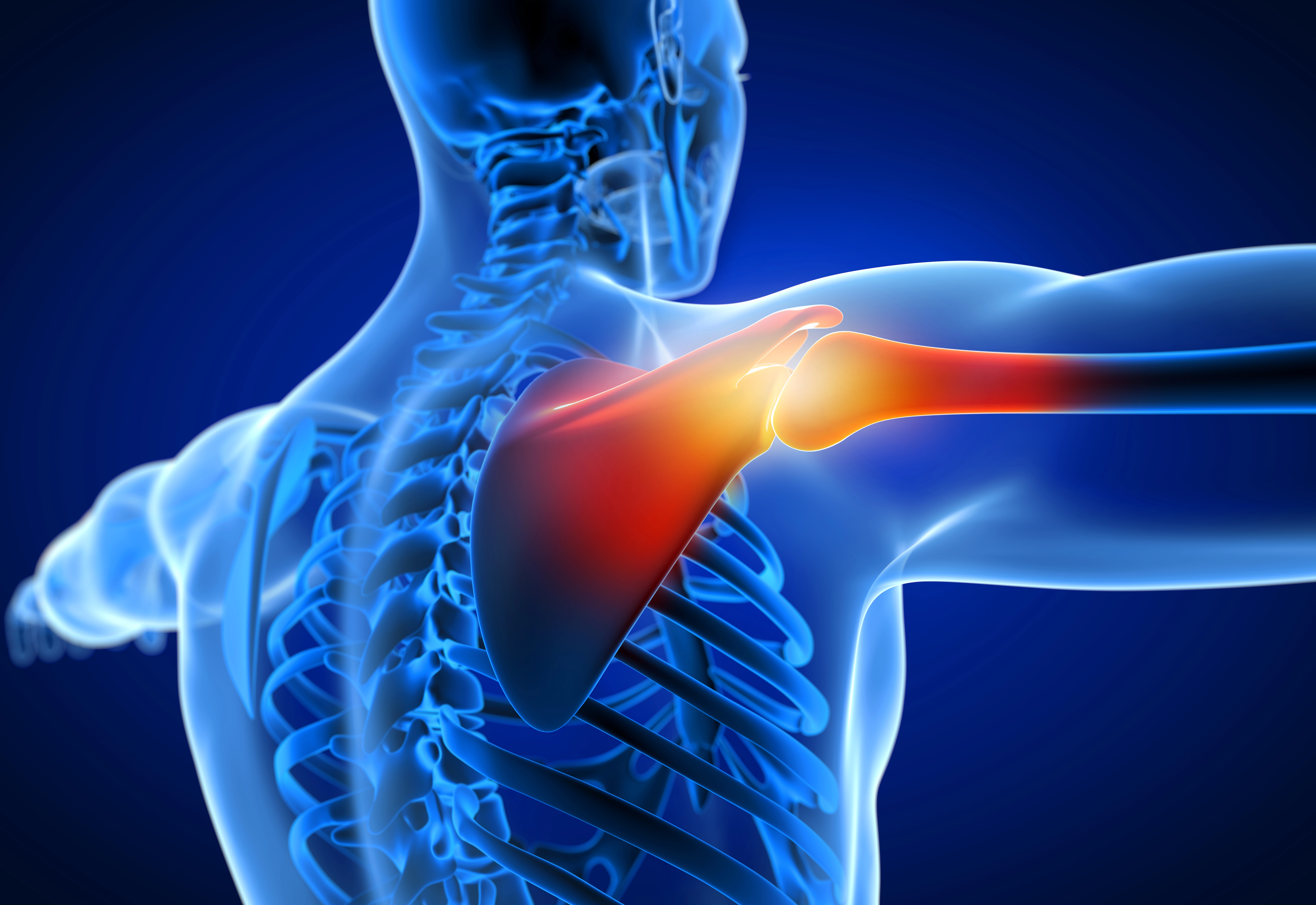 The top 5 Reasons for Shoulder Dislocations that you should know