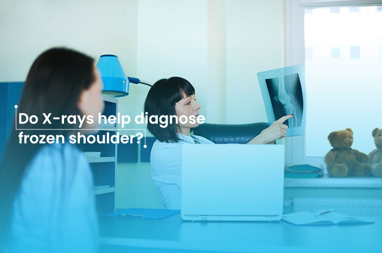Do X-rays help diagnose frozen shoulder?