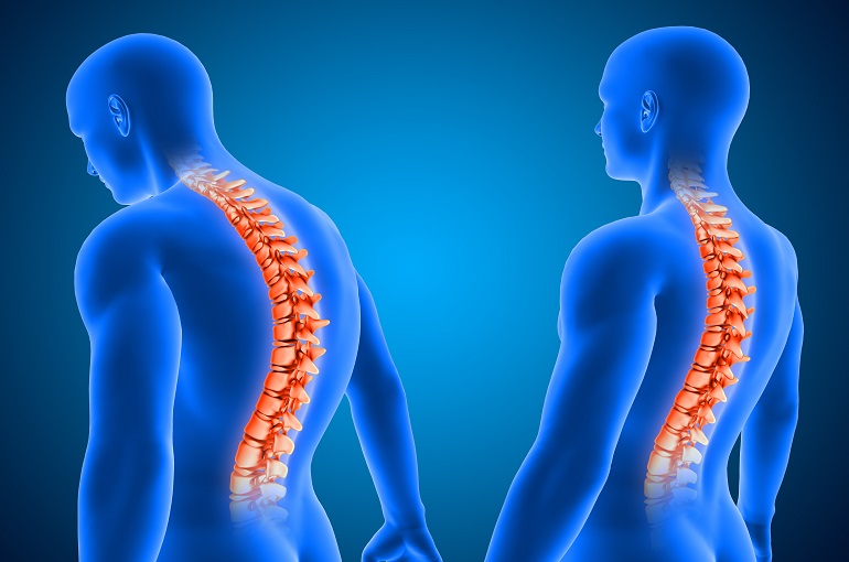 The Importance of Posture in Spine Health