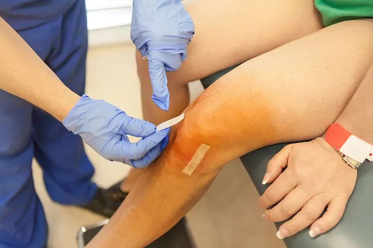What is Knee Arthroplasty? Benefits of knee arthroplasty treatment at the Dr. Sumitz clinic