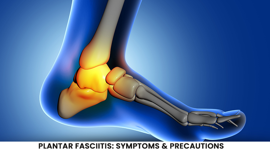 Plantar fasciitis: Symptoms & Precautions